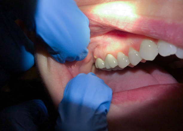 Best Root Canal Emergency Dentist  in Roselle Park, NJ
