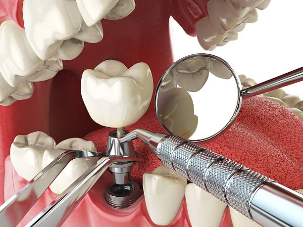 Best Cracked Tooth Emergency Dentist  in Roselle Park, NJ